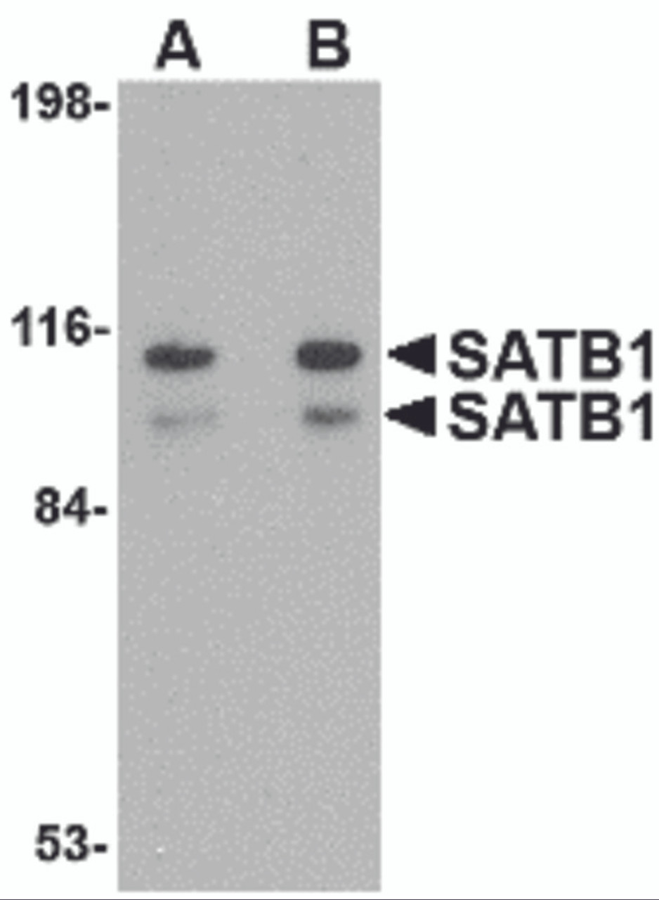 Western blot analysis of SATB1 in SK-N-SH cell lysate with SATB1 antibody at (A) 1 and (B) 2 &#956;g/mL.