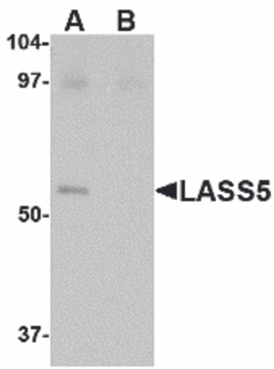 Western blot analysis of LASS5 in SK-N-SH lysate with LASS5 antibody at 1 &#956;g/mL in the (A) absence and (B) presence of blocking peptide.