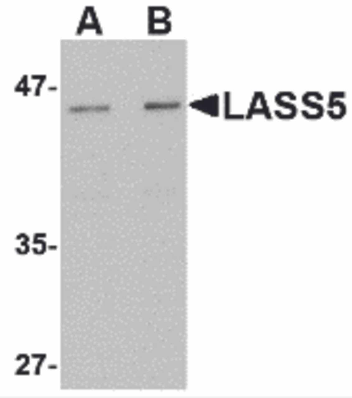 Western blot analysis of LASS5 in rat brain tissue lysate with LASS5 antibody at (A) 1 and (B) 2 &#956;g/mL.