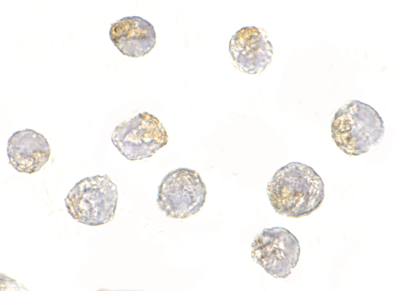 Immunocytochemistry of NUP107 in A549 cells with NUP107 antibody at 2.5 ug/mL.