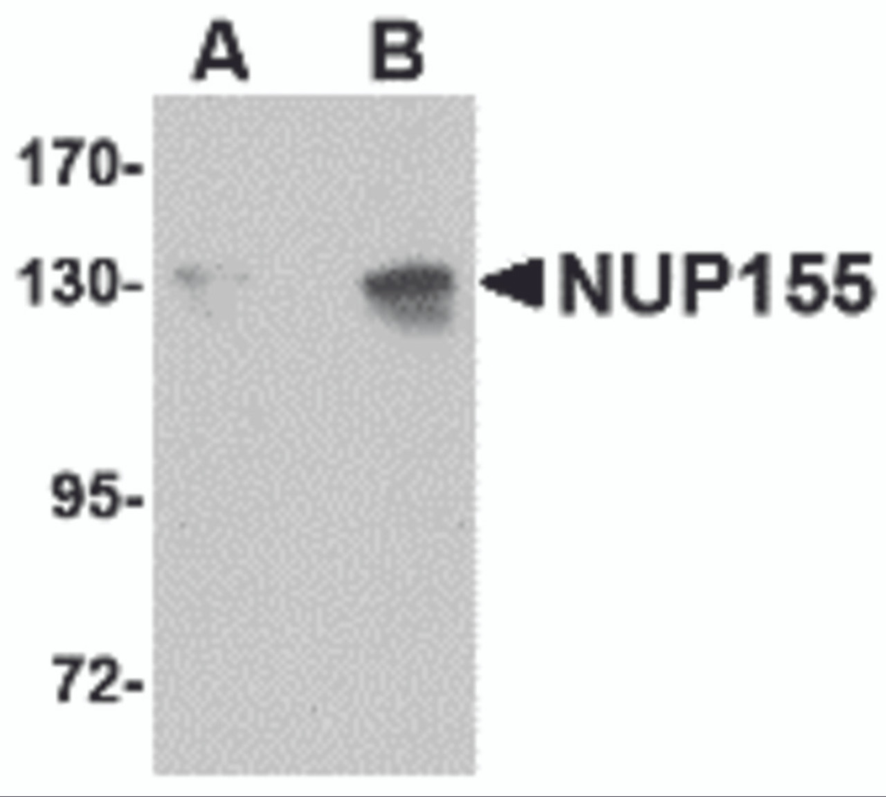 Western blot analysis of NUP155 in P815 cell lysate with NUP155 antibody at (A) 0.5 and (B) 1 &#956;g/mL.