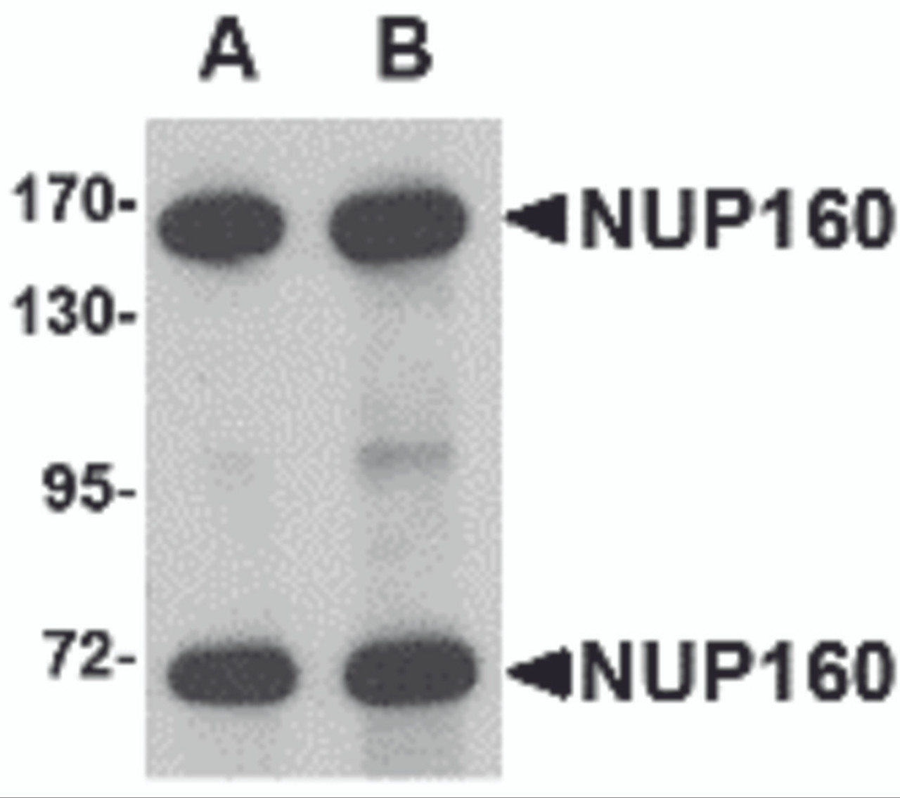 Western blot analysis of NUP160 in rat brain tissue lysate with NUP160 antibody at (A) 0.5 and (B) 1 &#956;g/mL.