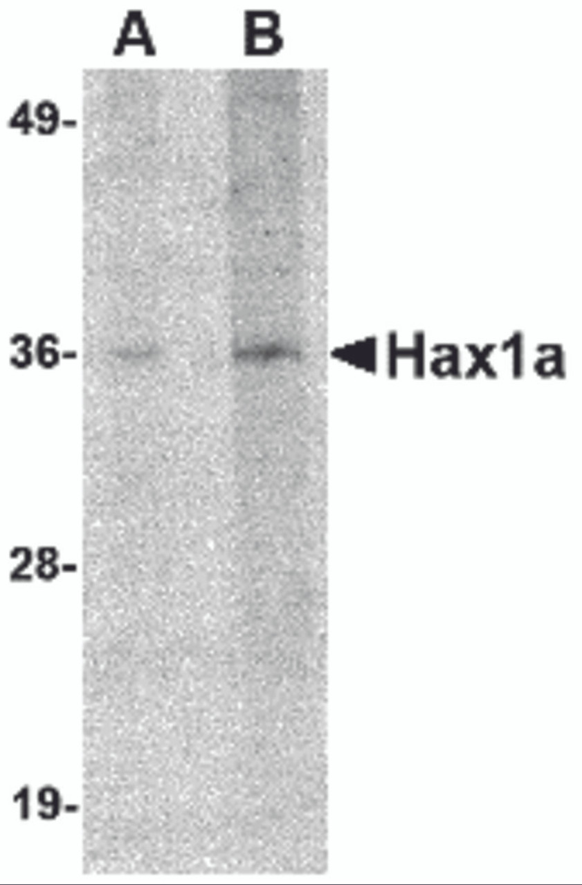 Western blot analysis of Hax1a in human brain tissue lysate with Hax1a antibody at (A) 1 and (B) 2 &#956;g/mL.