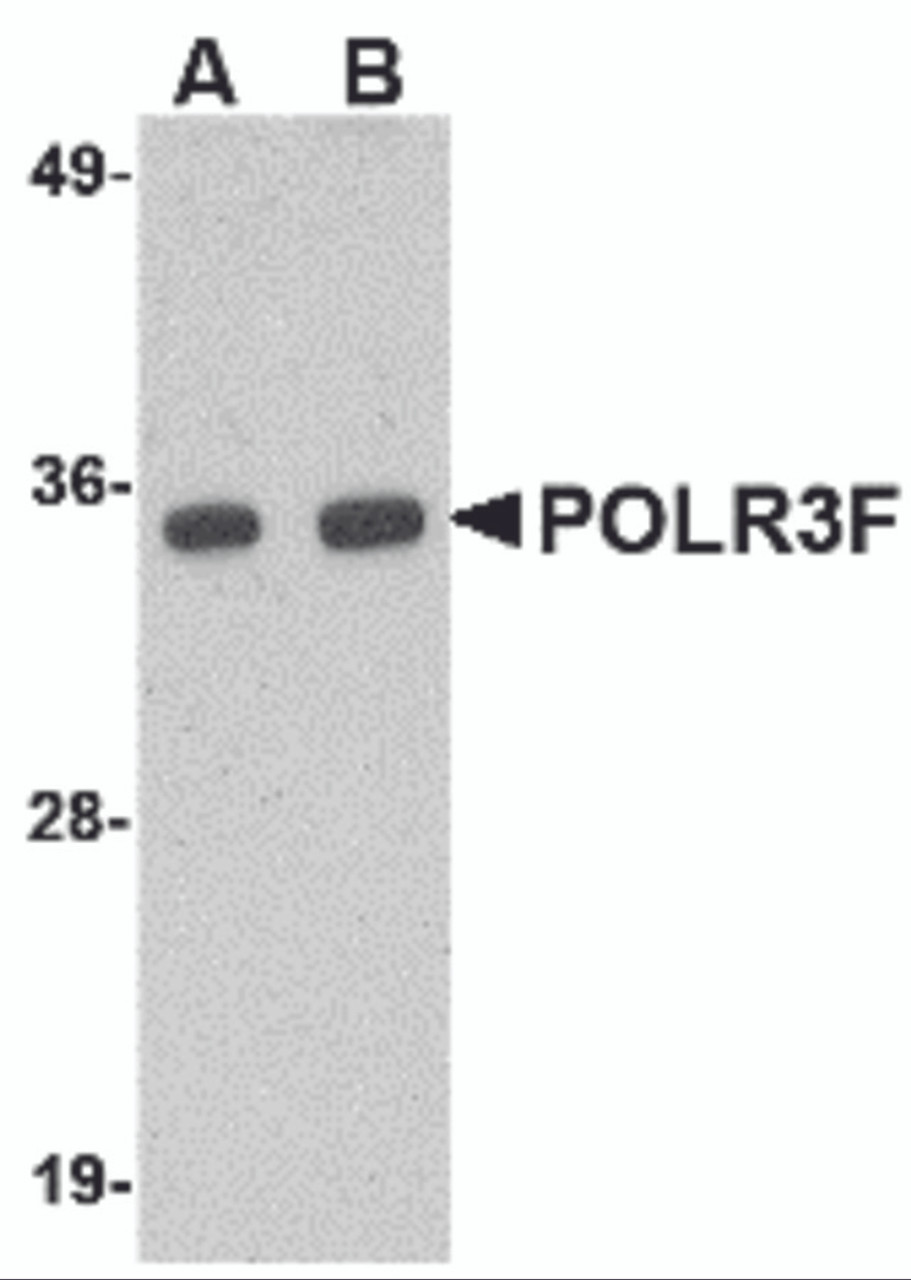 Western blot analysis of POLR3F in human brain tissue lysate with POLR3F antibody at (A) 0.5 and (B) 1 &#956;g/mL.