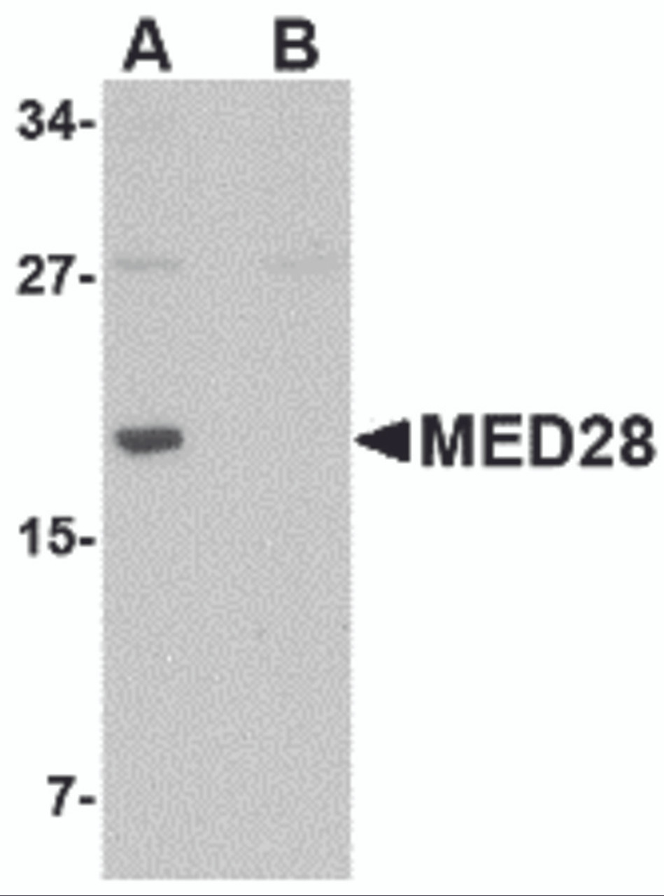 Western blot analysis of MED28 in human brain tissue lysate with MED28 antibody at 1 &#956;g/mL in (A) the absence and (B) the presence of blocking peptide.