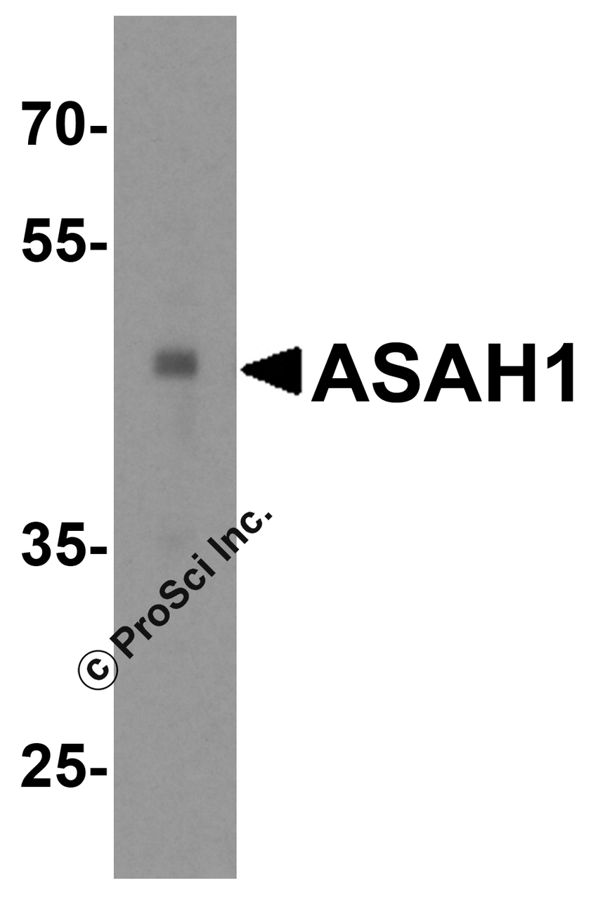 Western blot analysis of ASAH1 in human heart tissue lysate with ASAH1 antibody at 1 &#956;g/mL.
