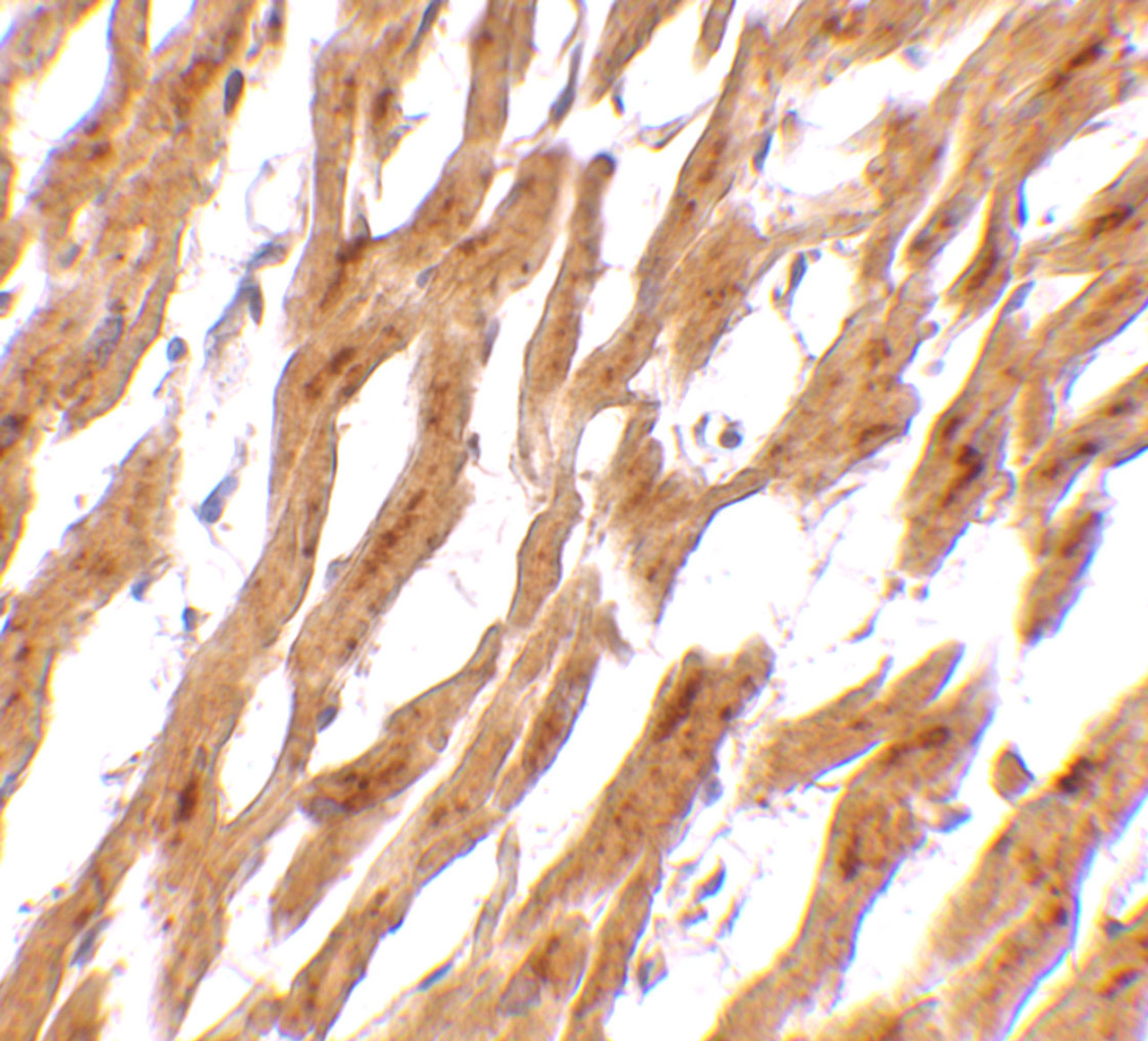 Immunohistochemistry of ASAH1 in human heart tissue with ASAH1 antibody at 2.5 ug/mL.