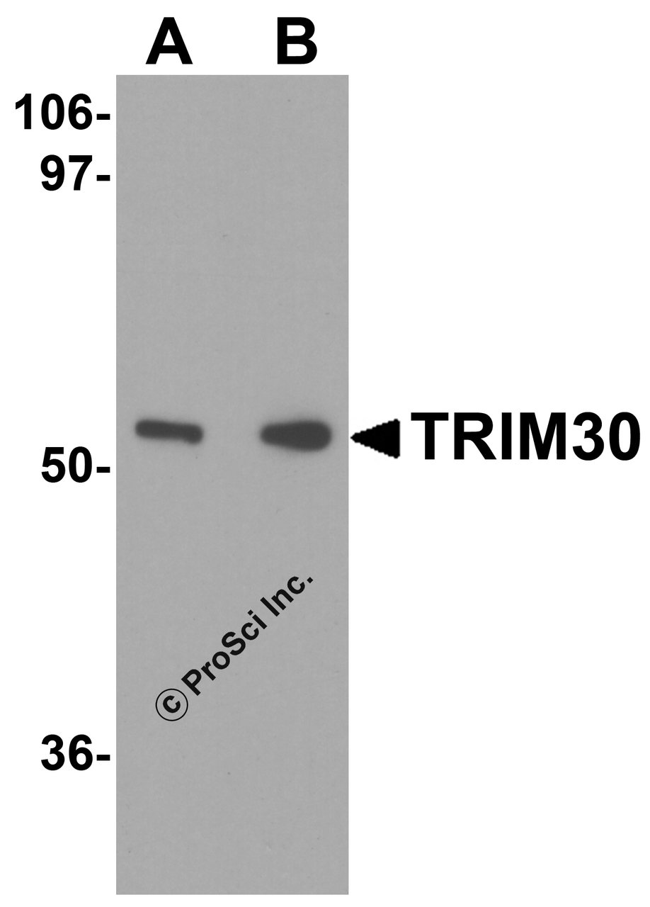 Western blot analysis of TRIM30 in mouse heart tissue lysate with TRIM30 antibody at (A) 1 and (B) 2 &#956;g/mL.
