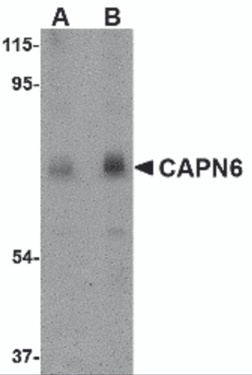 Western blot analysis of CAPN6 in rat lung tissue lysate with CAPN6 antibody at (A) 0.5 and (B) 1 &#956;g/mL.