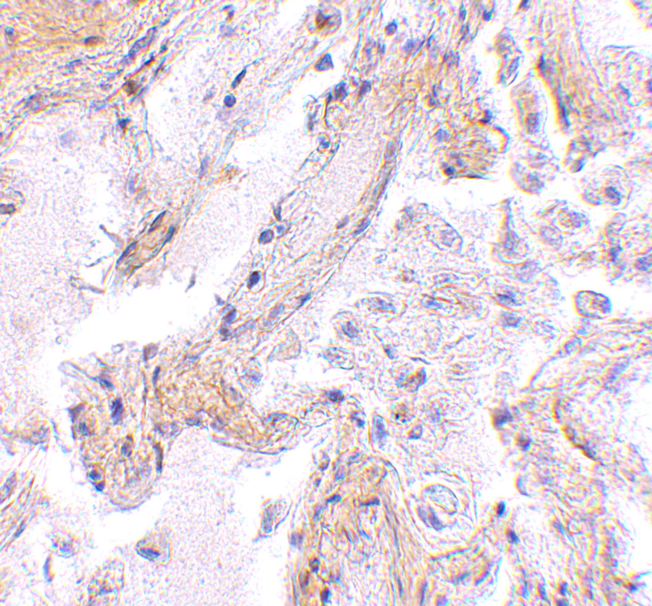 Immunohistochemistry of CAPN6 in human lung tissue with CAPN6 antibody at 2.5 ug/mL.