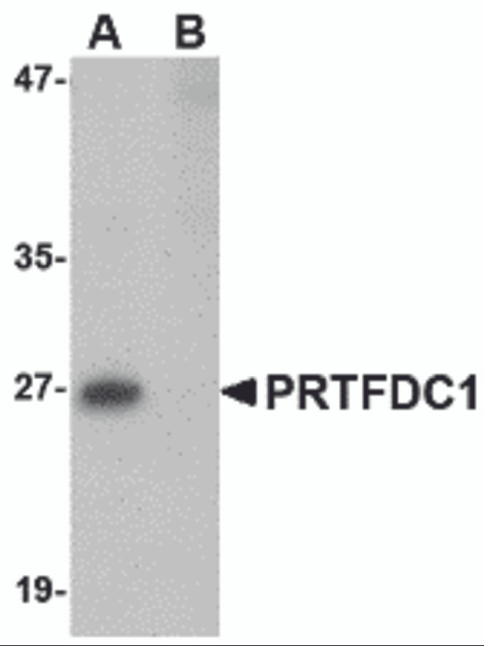 Western blot analysis of PRTFDC1 in human brain tissue lysate with PRTFDC1 antibody at 1 &#956;g/mL in the (A) absence and (B) presence of blocking peptide.