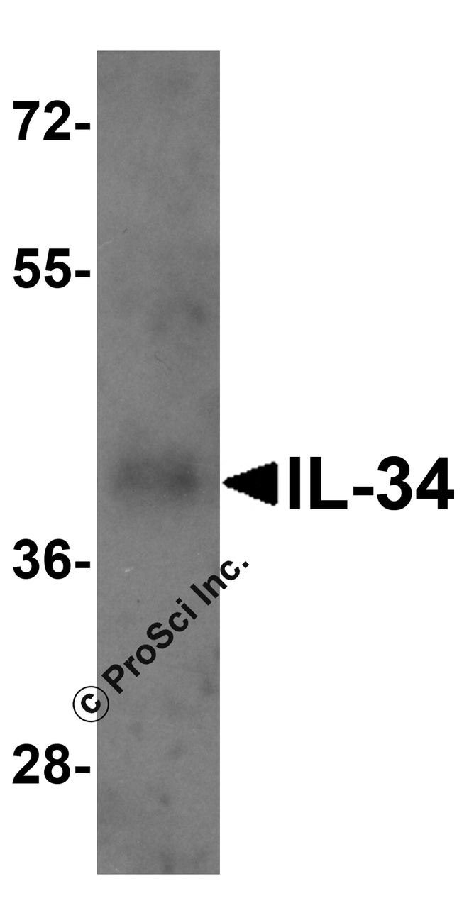 Western blot analysis of 1 ng of recombinant human IL-34 with IL-34 antibody at 1 ug/ml.