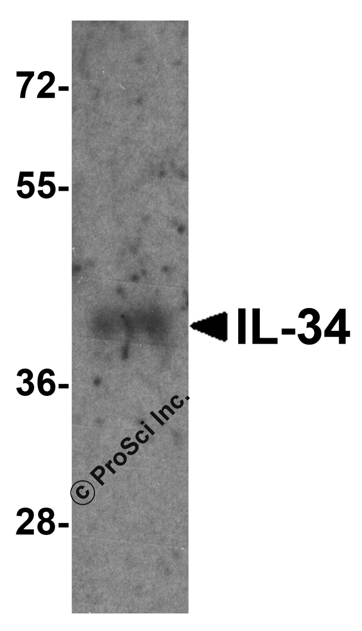 Western blot analysis of 125 ng of recombinant human IL-34 with IL-34 antibody at 1 ug/ml.