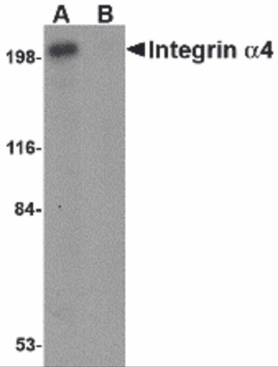 Western blot analysis of Integrin alpha 4 in Jurkat cell lysate with Integrin alpha 4 antibody at 1 &#956;g/mL in (A) the absence and (B) the presence of blocking peptide.
