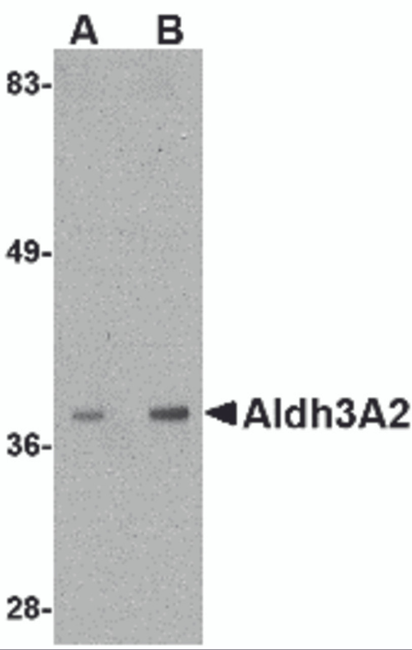 Western blot analysis of Aldh3A2 in mouse liver lysate with Aldh3A2 antibody at (A) 1 and (B) 2 &#956;g/mL.