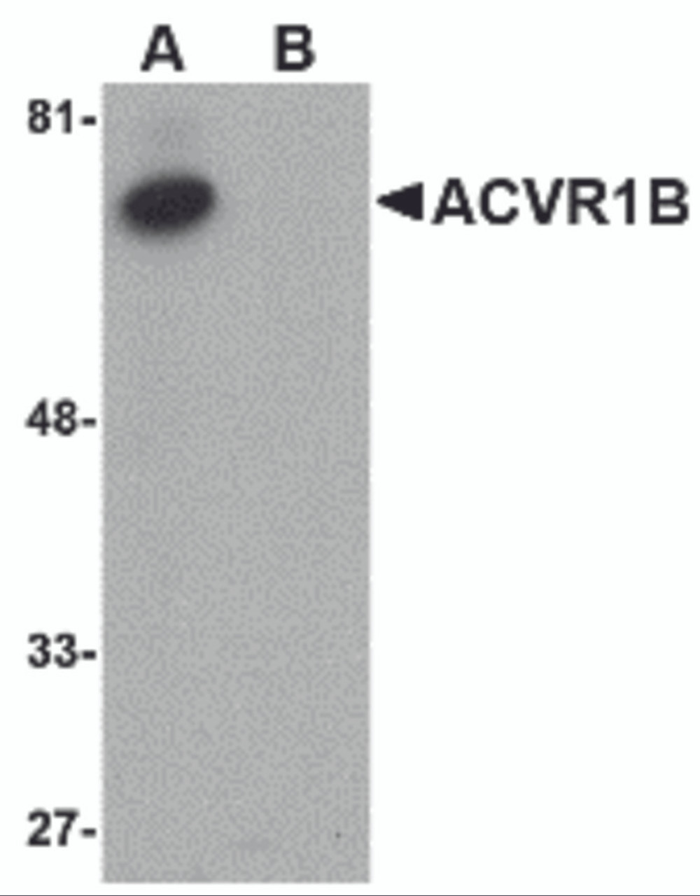 Western blot analysis of ACVR1B in human kidney tissue lysate with ACVR1B antibody at 1 &#956;g/mL in (A) the absence and (B) the presence of blocking peptide.
