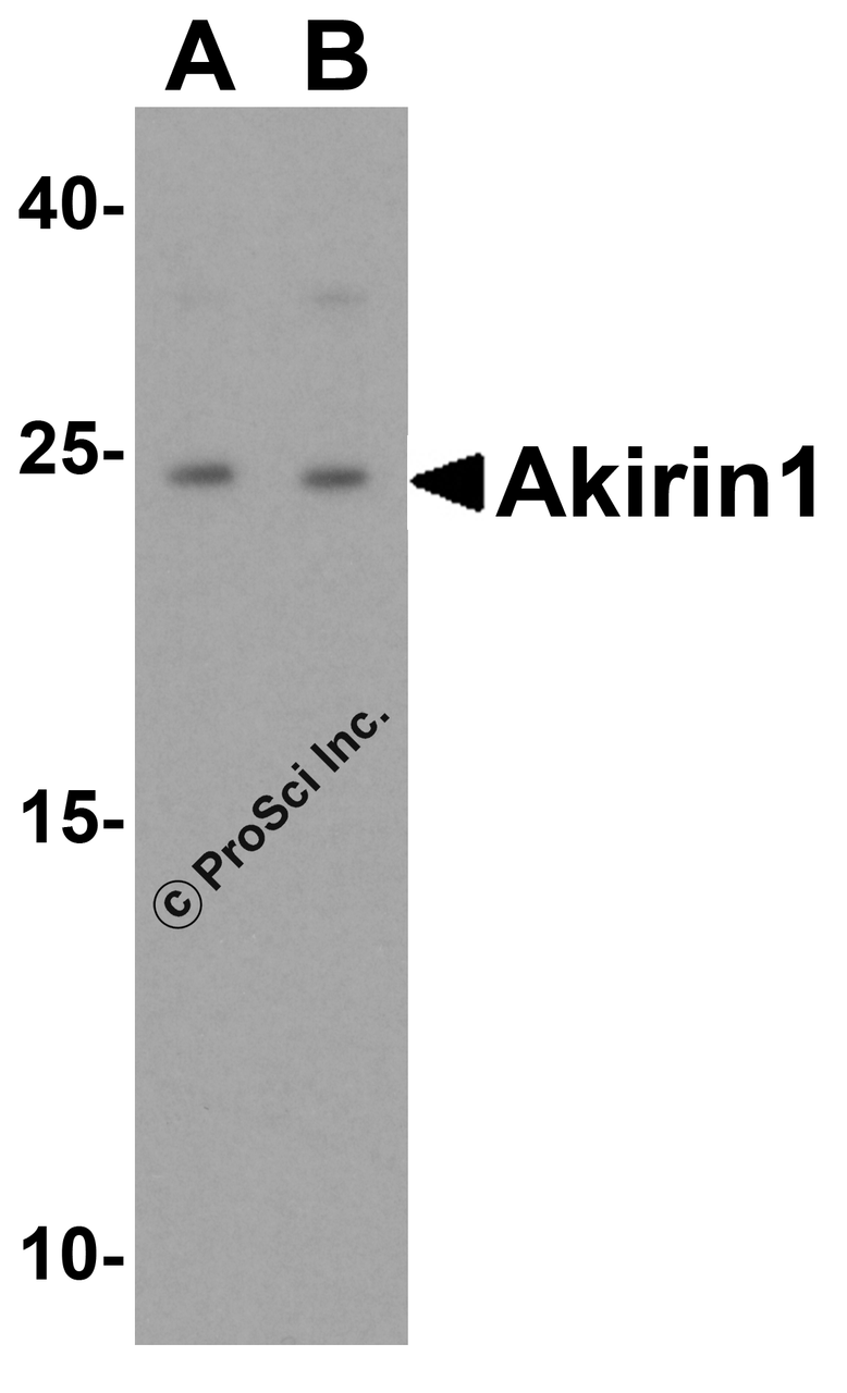 Western blot analysis of Akirin1 in rat liver tissue lysate with Akirin1 antibody at (A) 1 and (B) 2 &#956;g/mL.