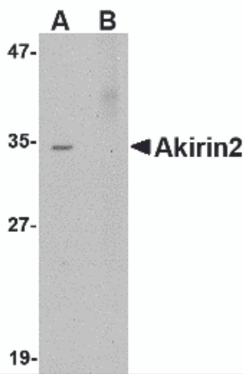 Western blot analysis of Akirin2 in Human Brain tissue lysate with Akirin2 antibody at 0.5 &#956;g/mL in (A) the absence and (B) the presence ofblocking peptide.