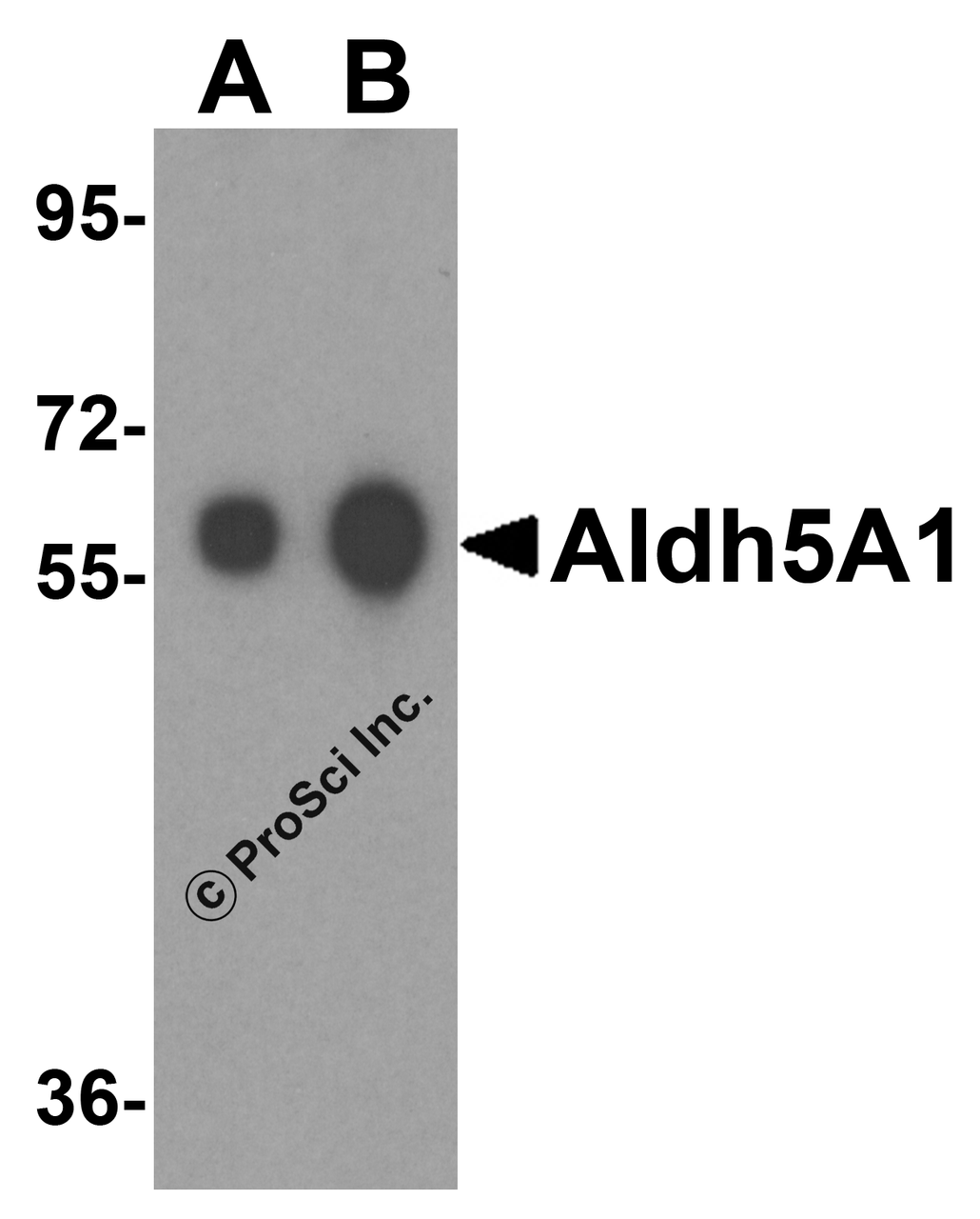 Western blot analysis of Aldh5A1 in human liver tissue lysate with Aldh5A1 antibody at (A) 0.25 and (B) 0.5 &#956;g/mL.
