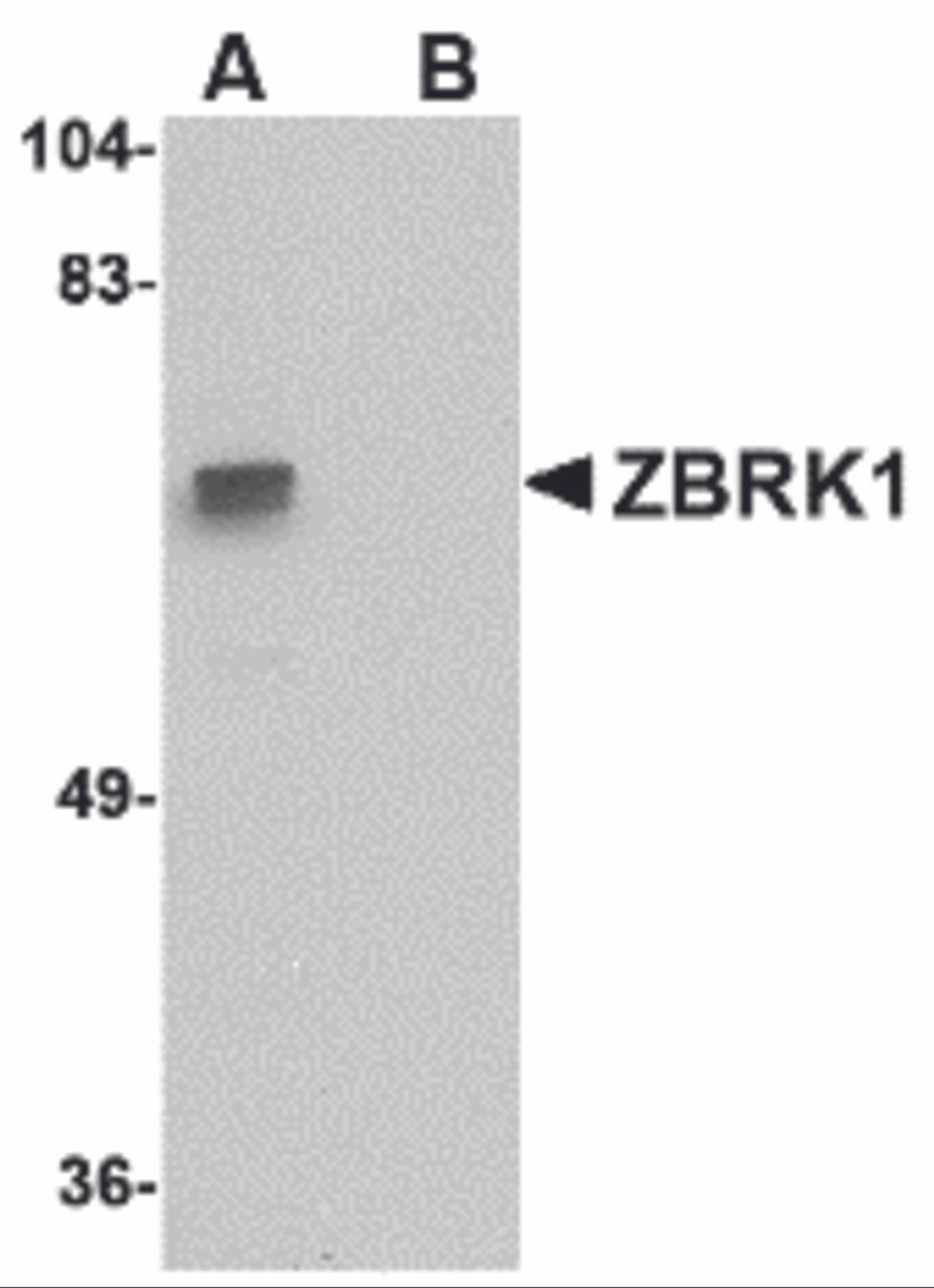 Western blot analysis of ZBRK1 in A-20 lysate with ZBRK1 antibody at 1 &#956;g/mL in (A) the absence and (B) the presence of blocking peptide.
