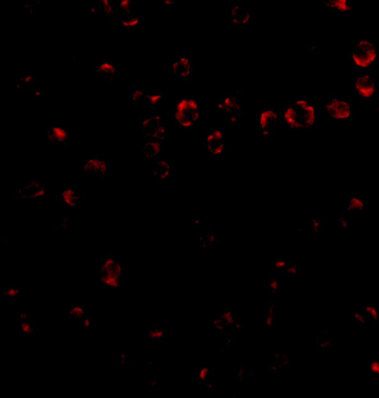 Immunofluorescence of Integrin alpha 4 in Jurkat cells with Integrin alpha 4 antibody at 2 ug/mL.