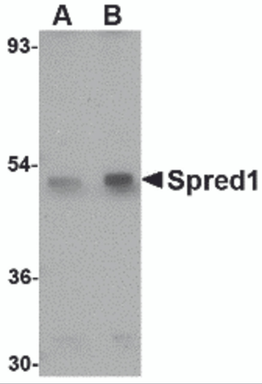 Western blot analysis of Spred1 in mouse brain tissue lysate with Spred1 antibody at (A) 1 and (B) 2 &#956;g/mL.