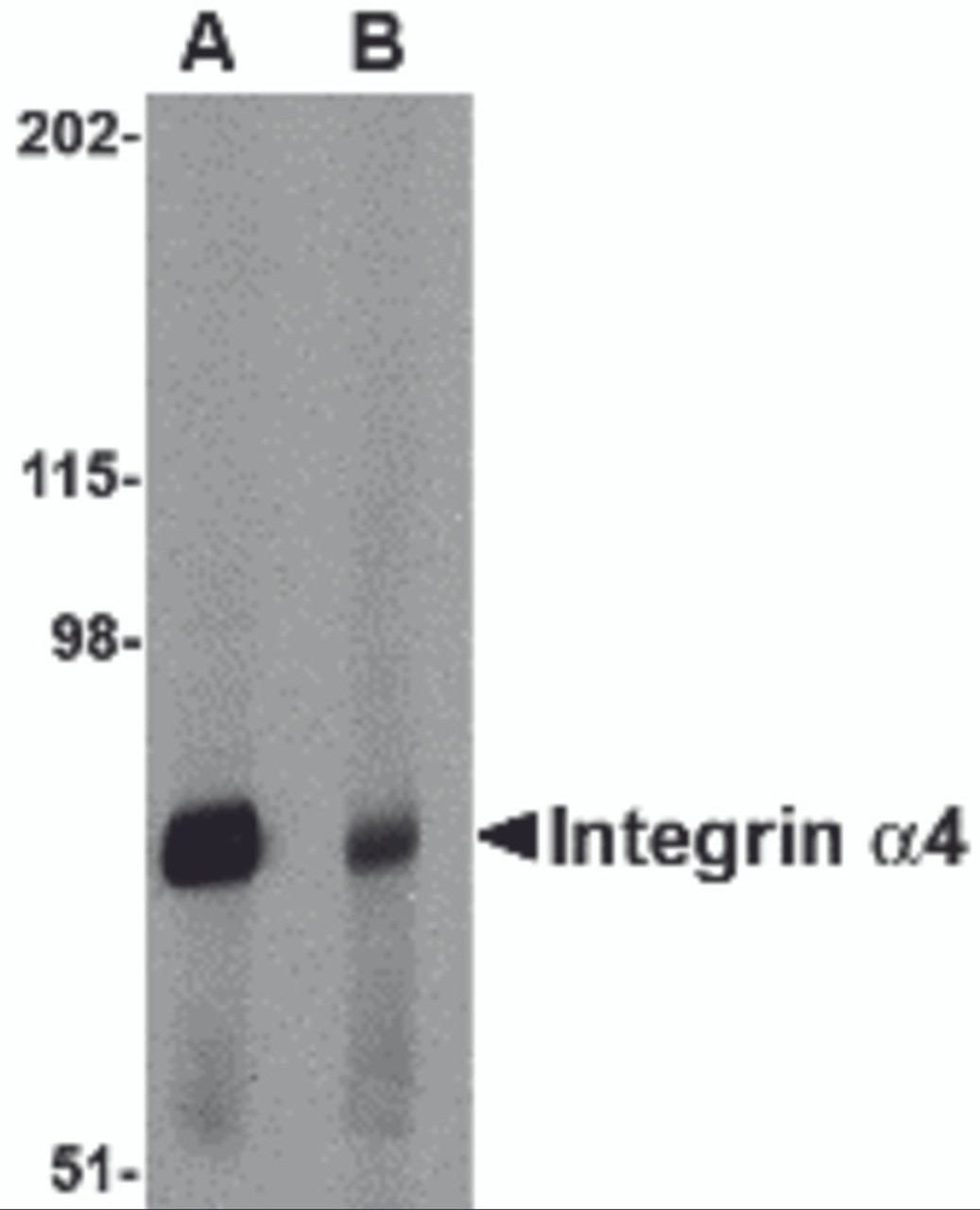 Western blot analysis of Integrin alpha 4 in rat spleen tissue lysate with Integrin alpha 4 antibody at 1 &#956;g/mL in (A) the absence and (B) the presence of blocking peptide.