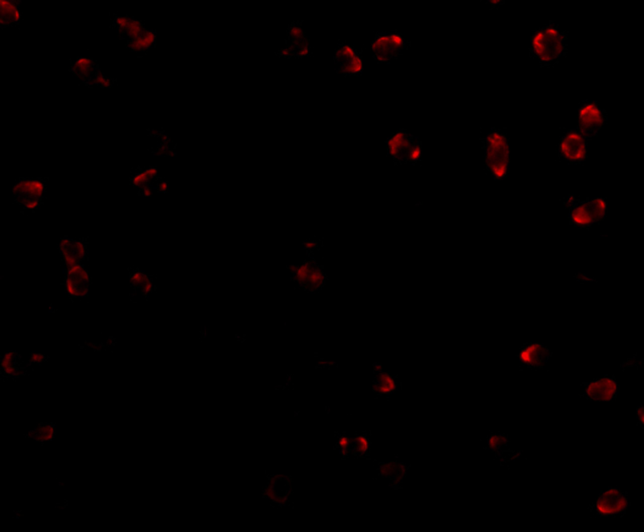 Immunofluorescence of Integrin alpha 4 in Jurkat cells with Integrin alpha 4 antibody at 2 ug/mL.