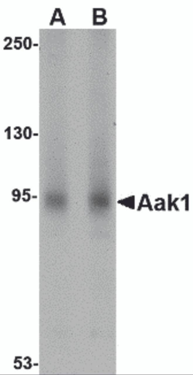 Western blot analysis of Aak1 in A-20 lysate with Aak1 antibody at (A) 1 and (B) 2 &#956;g/mL.