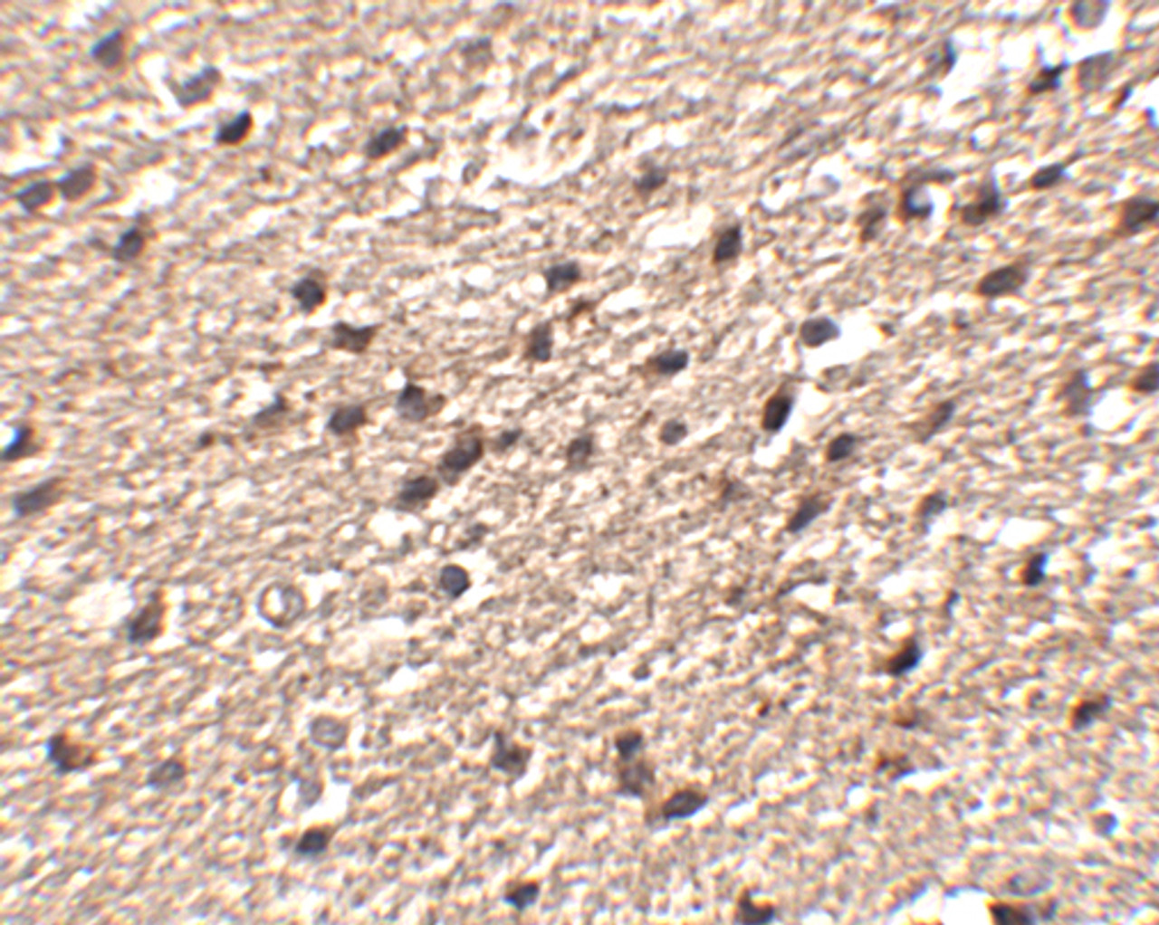 Immunohistochemistry of Stk39 in human brain tissue with Stk39 antibody at 2.5 ug/mL.