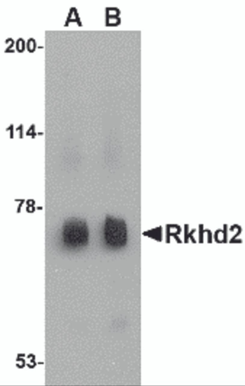 Western blot analysis of Rkhd2 in rat heart tissue lysate with Rkhd2 antibody at (A) 0.5 &#956;g/mL and (B) 1 &#956;g/mL.