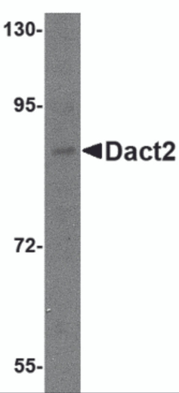Western blot analysis of Dact2 in SK-N-SH cell lysate with Dact2 antibody at 1 &#956;g/mL.