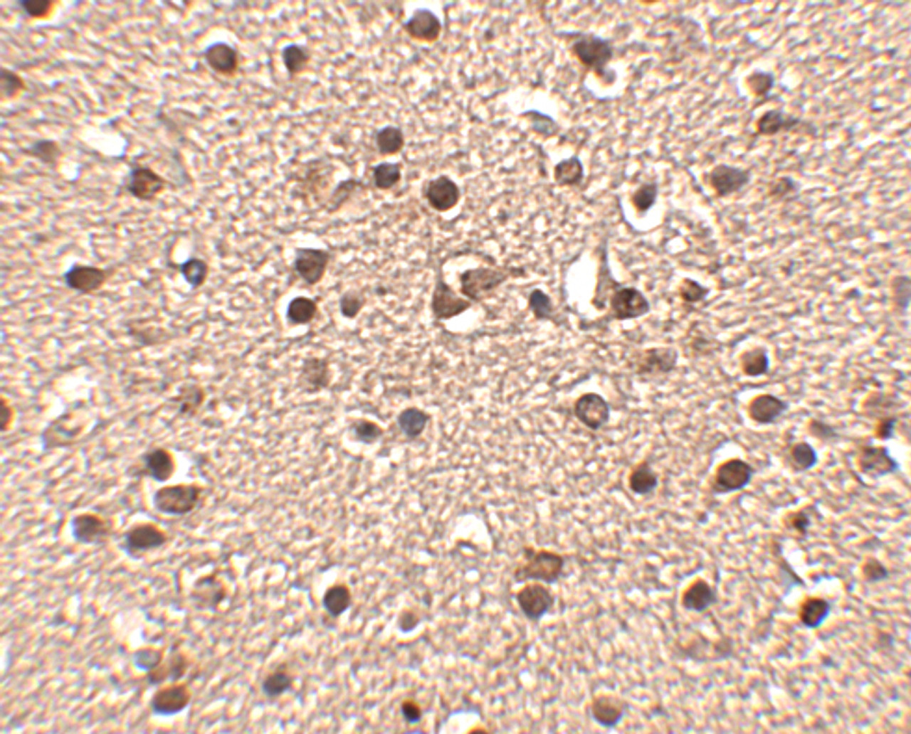 Immunohistochemistry of Dact2 in human brain tissue with Dact2 antibody at 2.5 ug/mL.