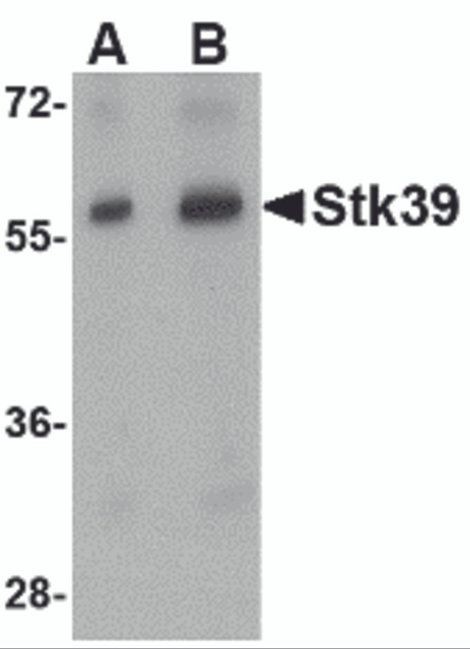 Western blot analysis of Stk39 in rat brain tissue lysate with Stk39 antibody at (A) 1 and (B) 2 &#956;g/mL.