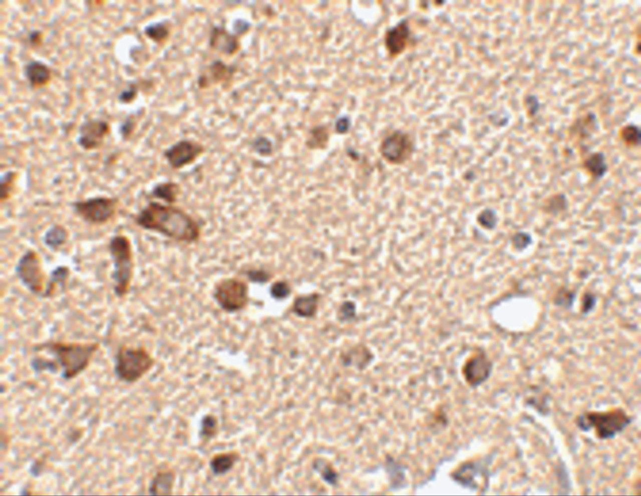 Immunohistochemistry of Stk39 in human brain tissue with Stk39 antibody at 2.5 ug/mL.