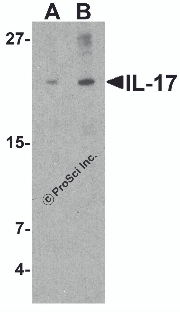 Figure 1 Western Blot Validation in Human THP-1 Cell Lysate
Loading: 15 &#956;g of lysates per lane.
Antibodies: IL-17 4877 (A: 1 &#956;g/mL and B: 2 &#956;g/mL) , 1h incubation at RT in 5% NFDM/TBST.
Secondary: Goat anti-rabbit IgG HRP conjugate at 1:10000 dilution.