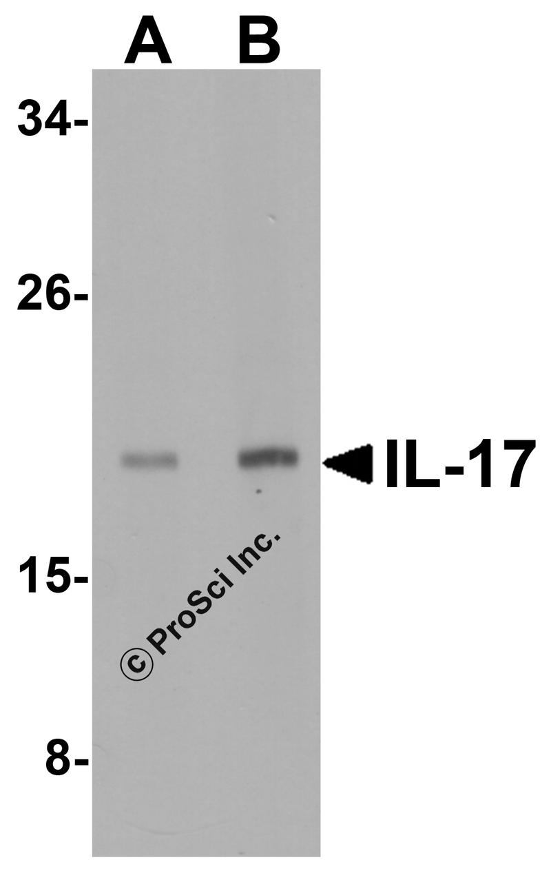 Figure 2 Western Blot Validation in A-20 Cell Lysate
Loading: 15 ug of lysates per lane.
Antibodies: IL-17 4877 (A: 2 ug/mL and B: 4 ug/mL) , 1h incubation at RT in 5% NFDM/TBST.
Secondary: Goat anti-rabbit IgG HRP conjugate at 1:10000 dilution.
