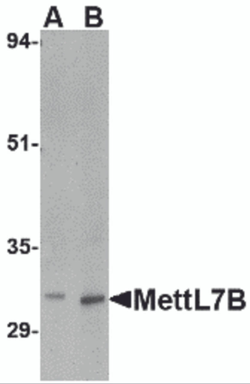 Western blot analysis of MettL7B in rat spleen tissue lysate with MettL7B antibody at (A) 2 and (B) 4 &#956;g/mL.