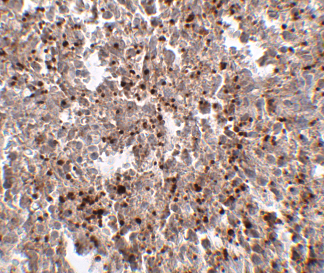 Immunohistochemistry of Mett7LB in human spleen tissue with MettL7B antibody at 2.5 ug/mL.