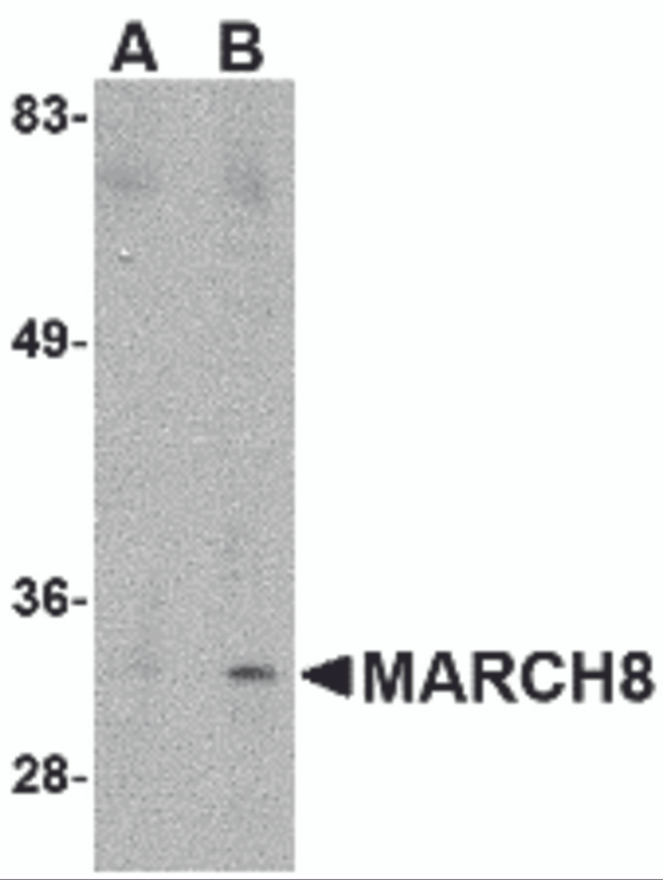 Western blot analysis of MARCH8 in HeLa cell lysate with MARCH8 antibody at (A) 0.5 &#956;g/ml and (B) 1 &#956;g/mL.