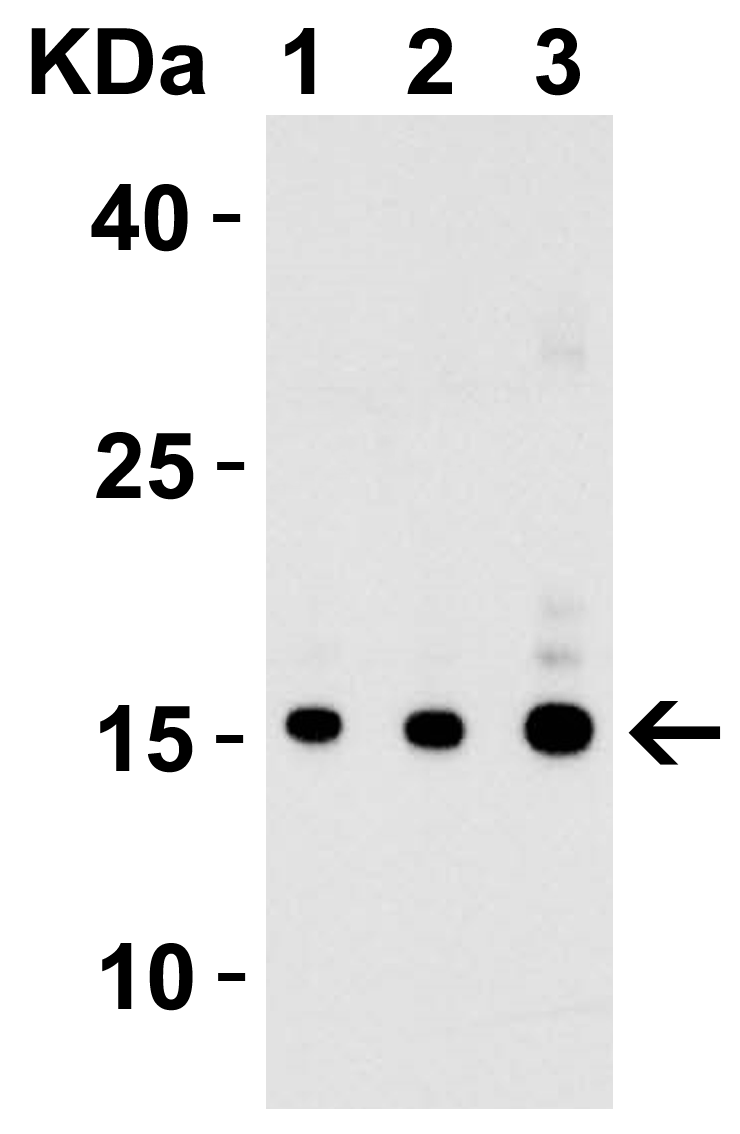 Figure 1 Western Blot Validation with Recombinant Protein
Loading: 30 ng of human IL-17 recombinant protein per lane.
Antibodies: IL-17 4887, 1h incubation at RT in 5% NFDM/TBST.
Secondary: Goat anti-rabbit IgG HRP conjugate at 1:10000 dilution.
Lane 1: 0.125 μg/mL
Lane 2: 0.25 μg/mL
Lane 3: 0.5 μg/mL