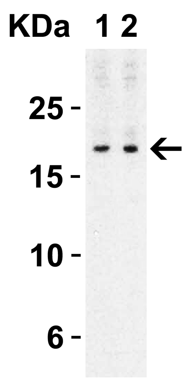 Figure 2 Western Blot Validation with Human Spleen 
Loading: 10 ug of lysates per lane.
Antibodies: IL-17 4887, 1h incubation at RT in 5% NFDM/TBST.
Secondary: Goat anti-rabbit IgG HRP conjugate at 1:10000 dilution.
Exposure: 1 min
Lane 1: 1 ug/mL 
Lane 2: 2 ug/mL