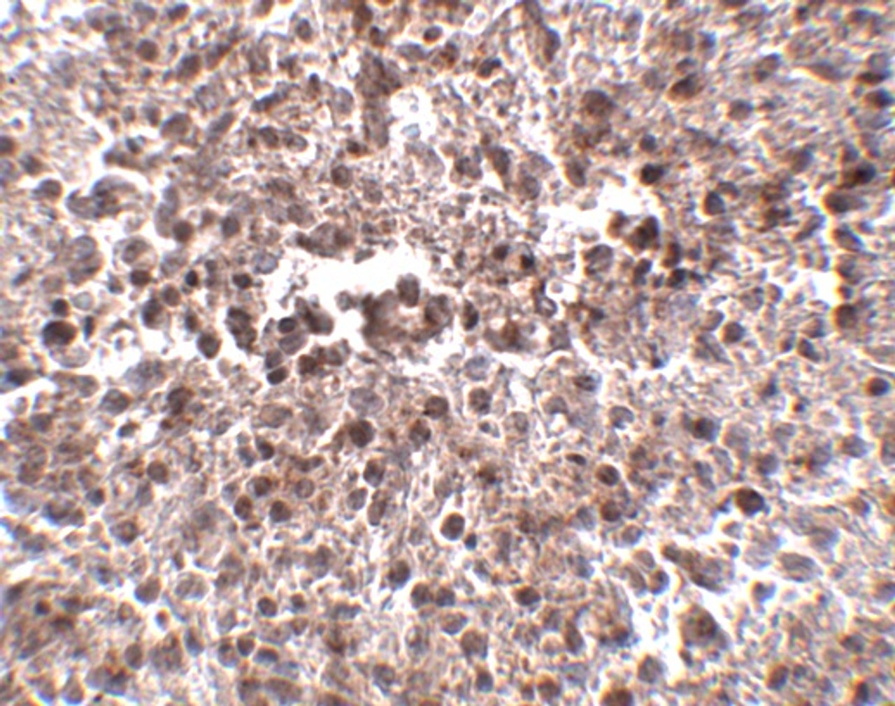 Immunohistochemistry of MettL7B in human spleen tissue with MettL7B antibody at 2.5 ug/mL.