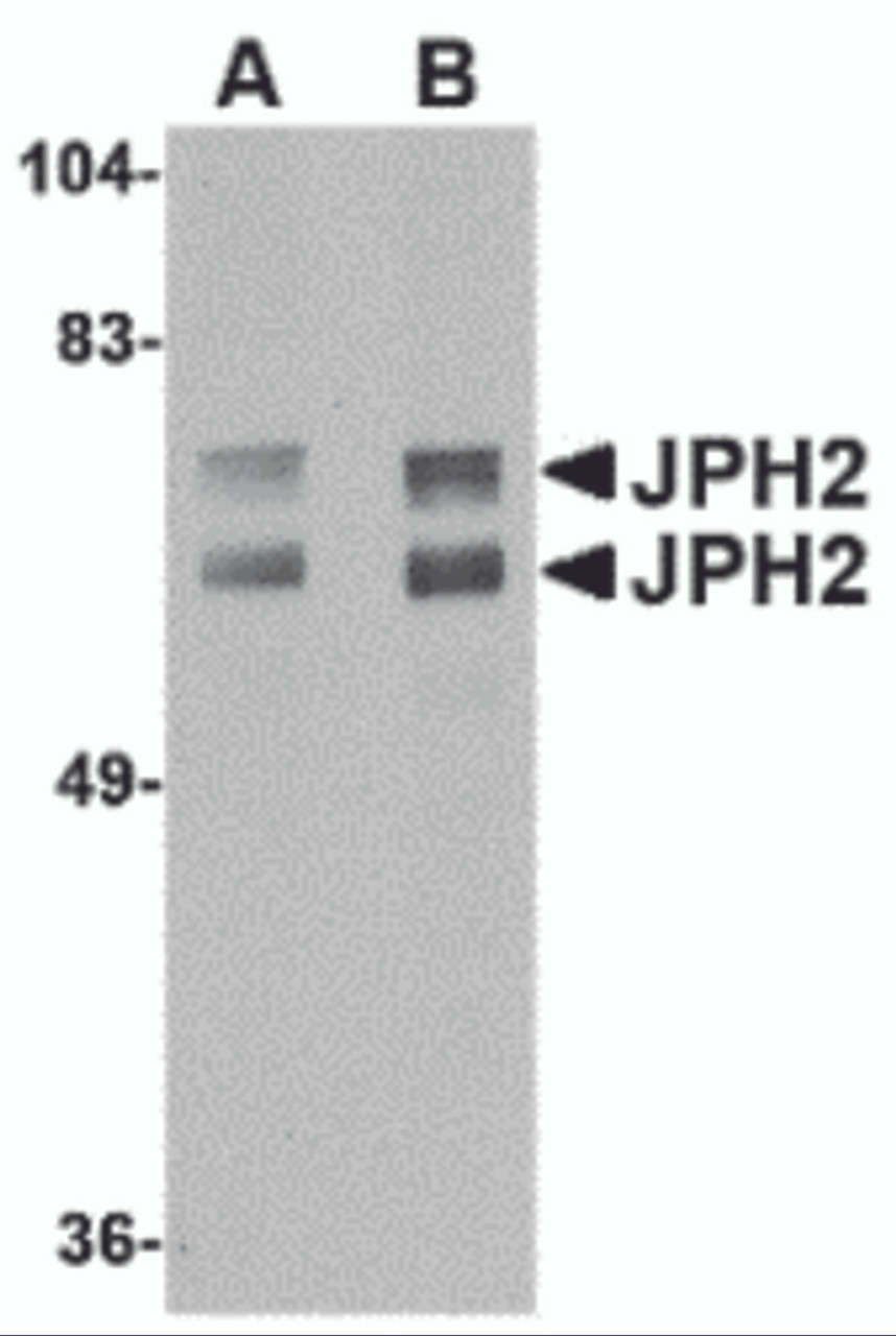 Western blot analysis of JPH2 in mouse brain tissue lysate with JPH2 antibody at (A) 1 and (B) 2 &#956;g/mL.