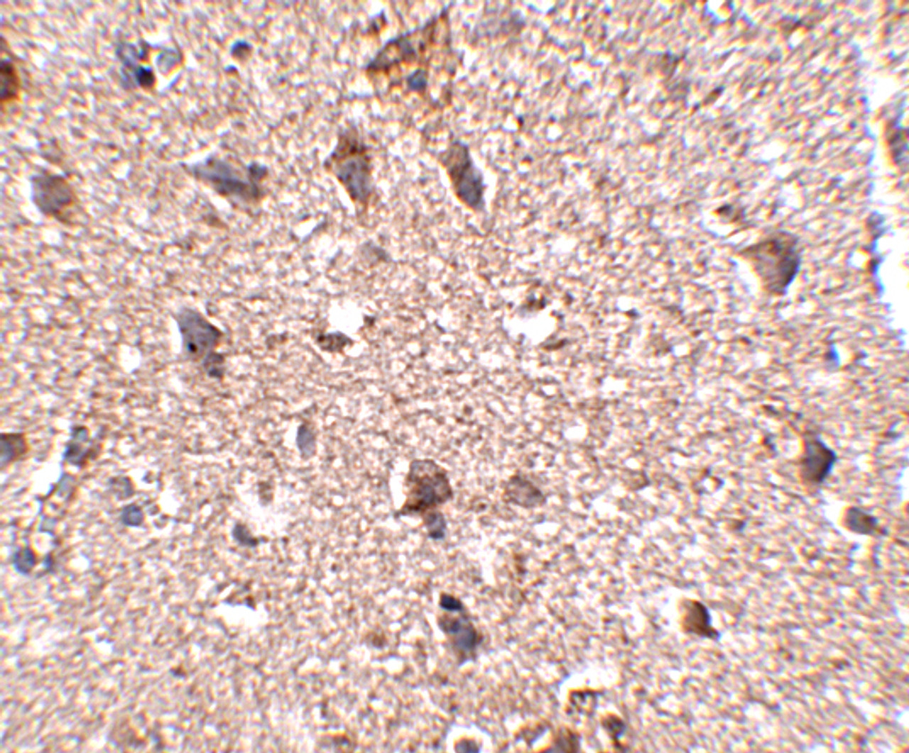 Immunohistochemistry of JPH3 in human brain tissue with JPH3 antibody at 2.5 ug/mL.