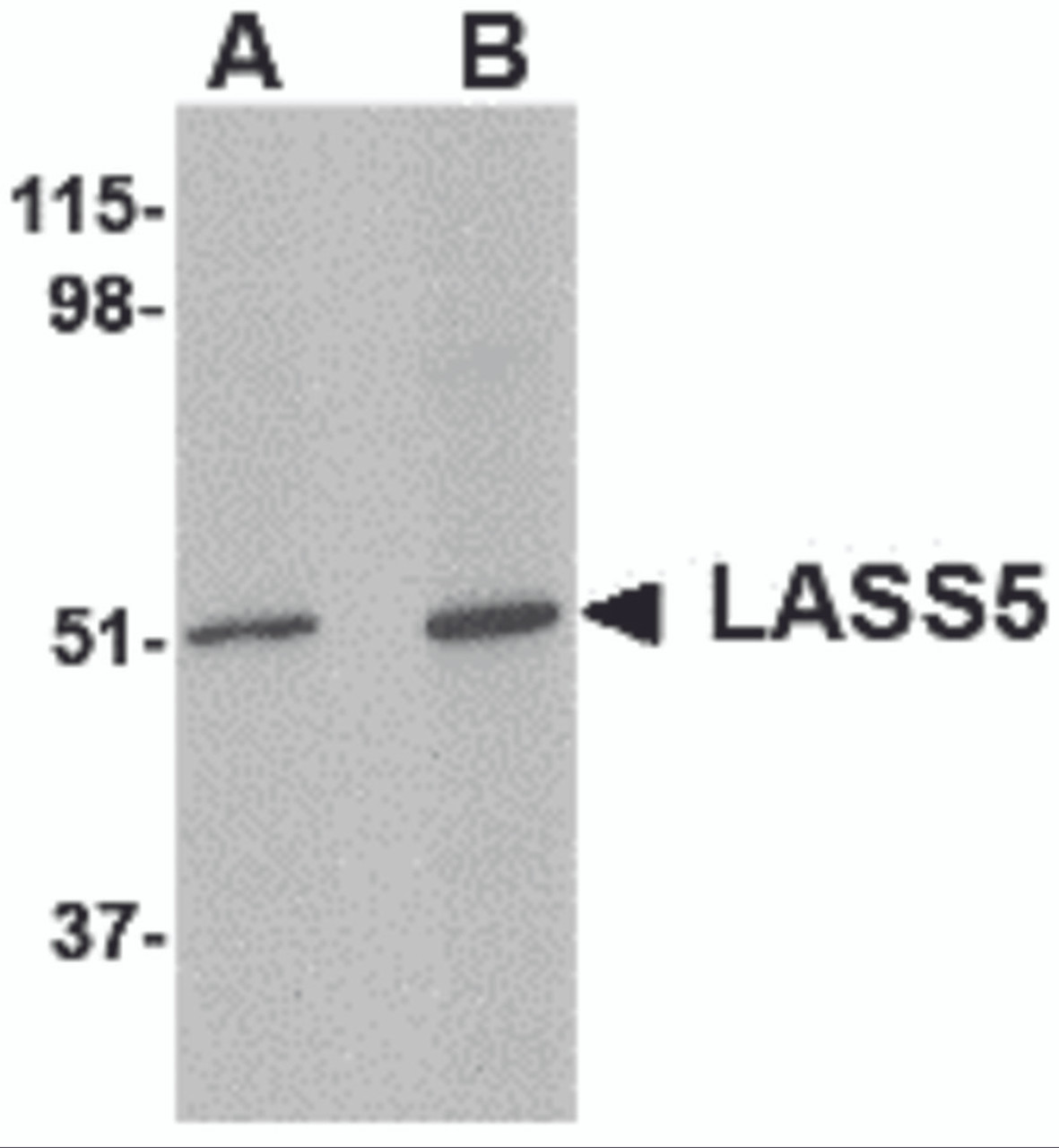 Western blot analysis of LASS5 in SK-N-SH lysate with LASS5 antibody at (A) 1 and (B) 2 &#956;g/mL.