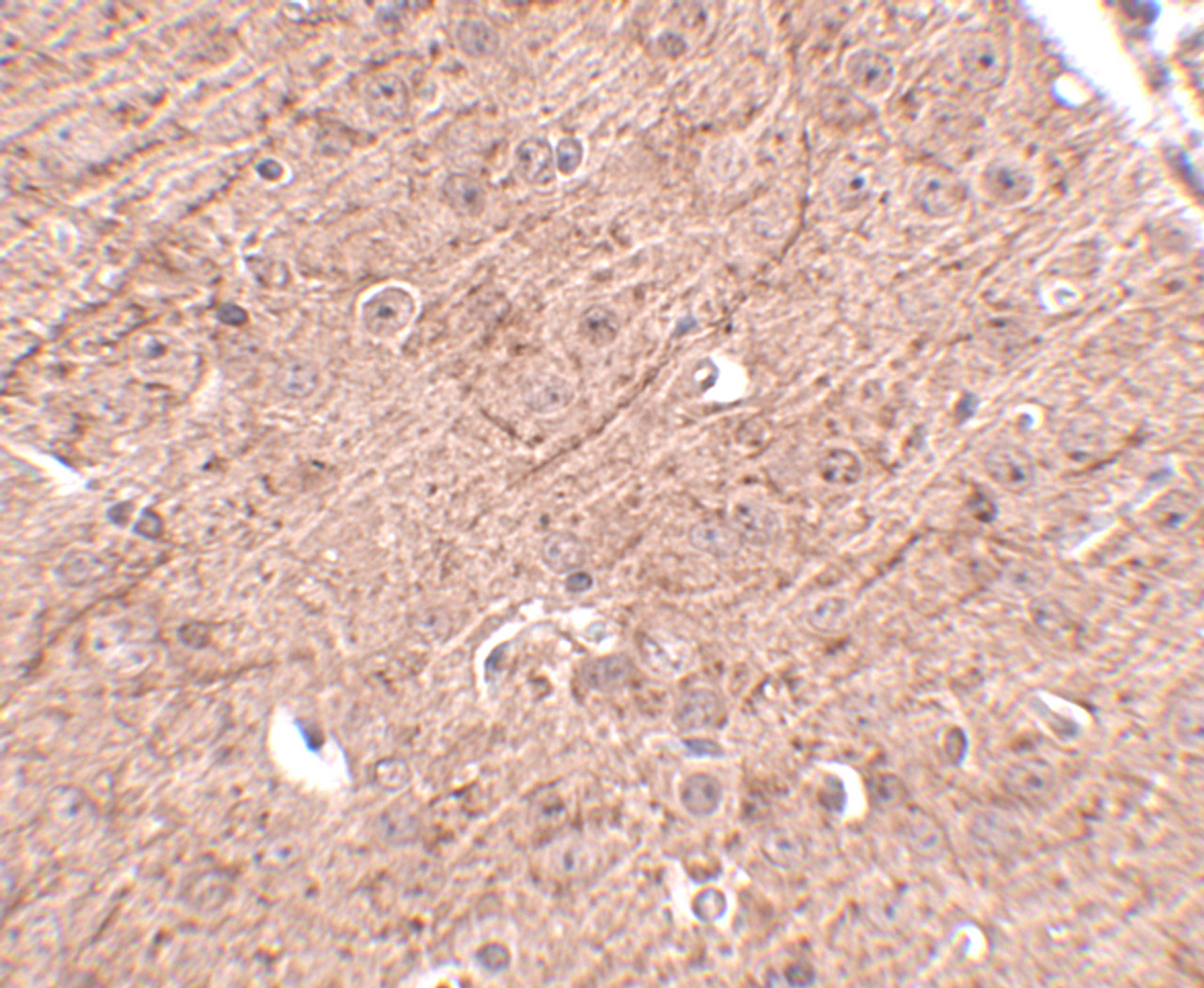 Immunohistochemistry of LASS5 in mouse brain tissue with LASS5 antibody at 2.5 ug/mL.