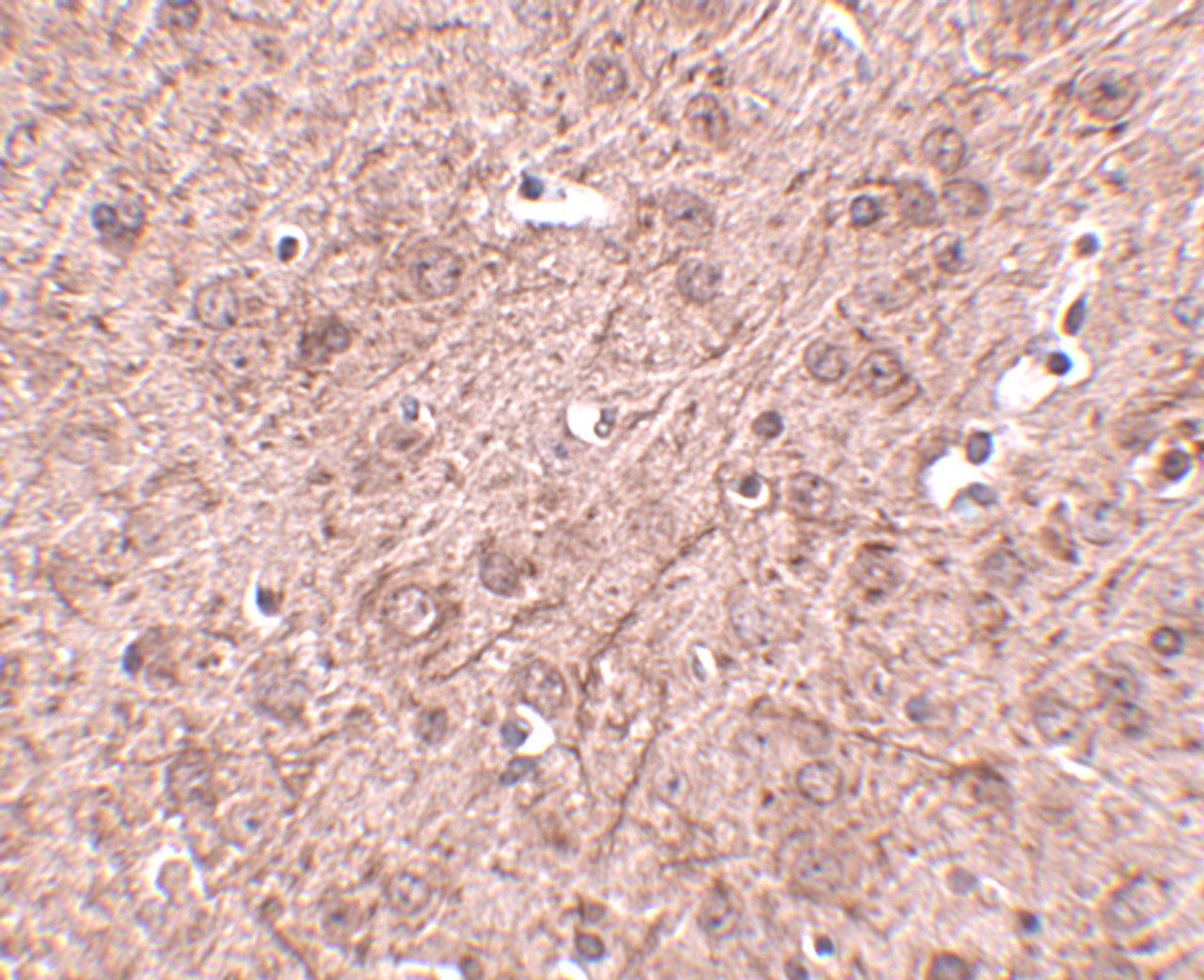Immunohistochemistry of LASS6 in mouse brain tissue with LASS6 antibody at 2.5 ug/mL.