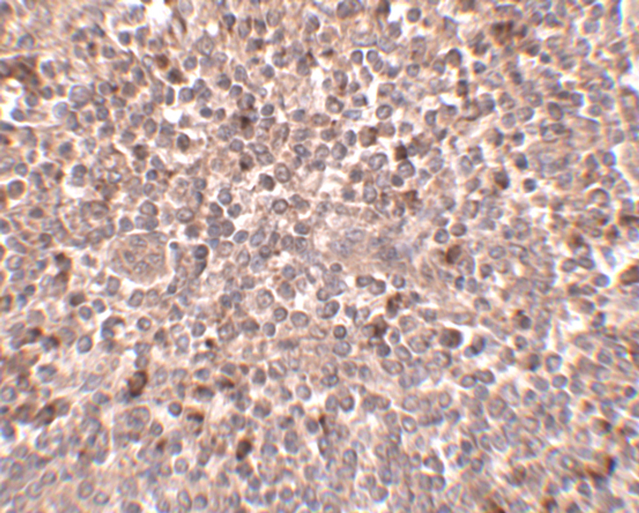 Immunohistochemistry of PIGY in human spleen tissue with PIGY antibody at 2.5 ug/mL.