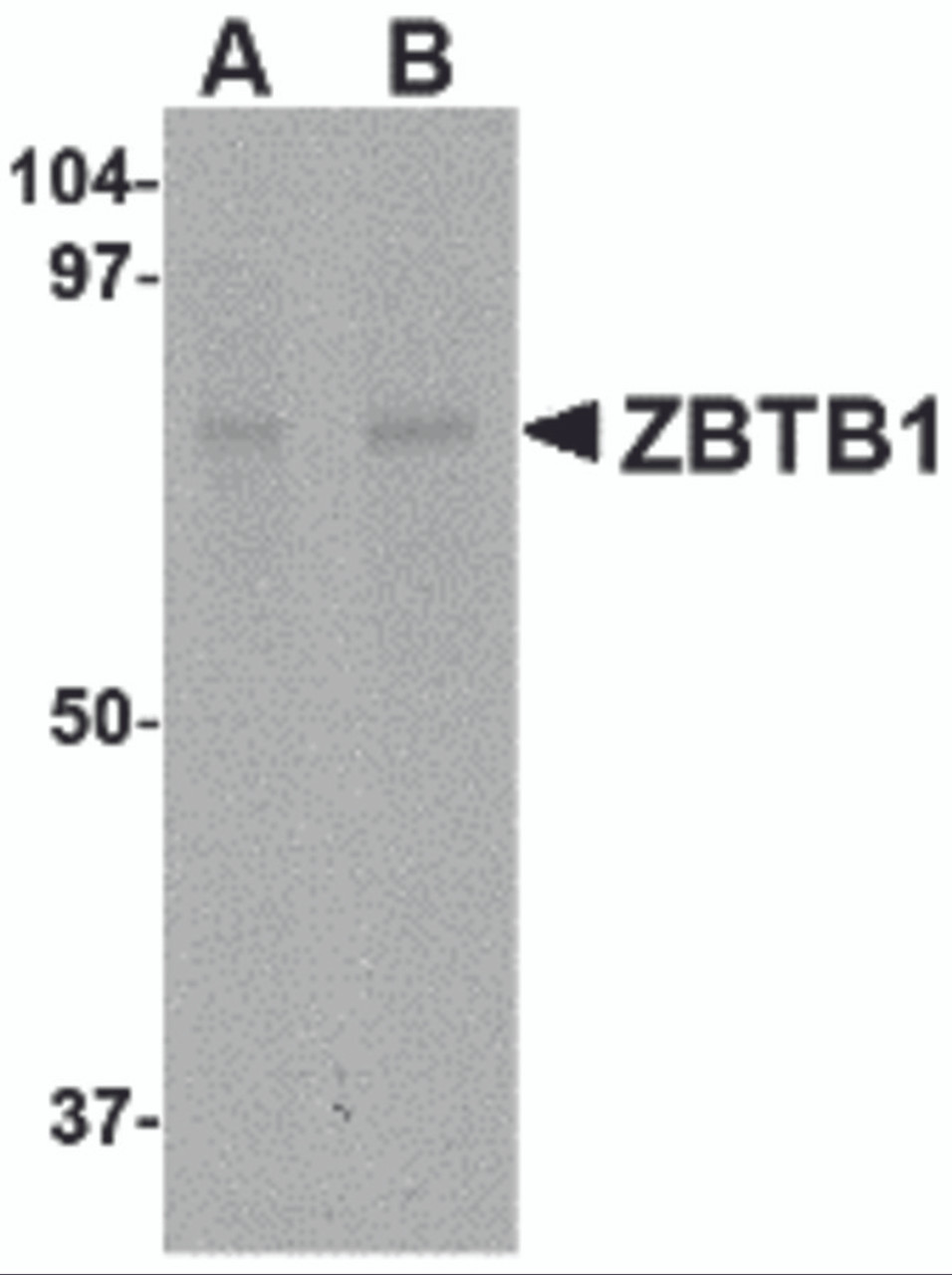 Western blot analysis of ZBTB1 in HepG2 lysate with ZBTB1 antibody at (A) 1 and (B) 2 &#956;g/mL.